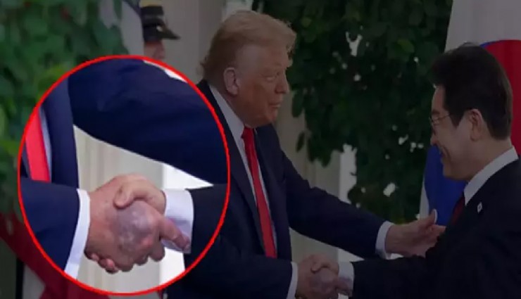 Trump'ın elindeki morluk hakkında Beyaz Saray'dan açıklama