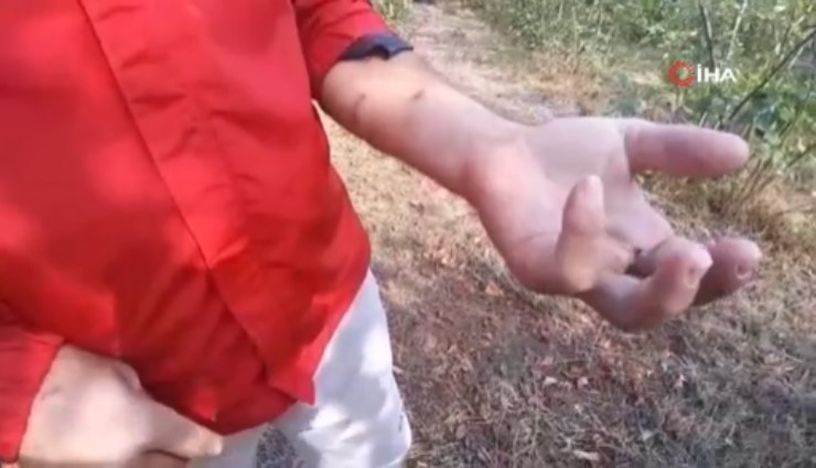 Bolu'da ayı saldırısına uğrayan adam o anları anlattı: 