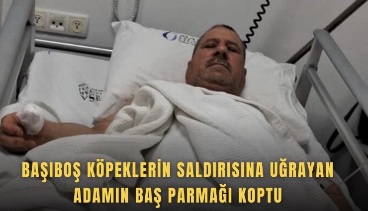 Başıboş köpeklerin saldırısına uğrayan adamın baş parmağı koptu