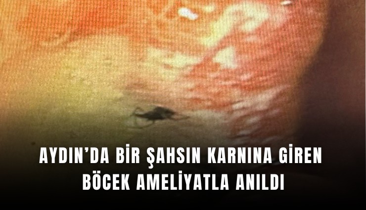 Aydın’da bir şahsın karnına giren böcek ameliyatla anıldı
